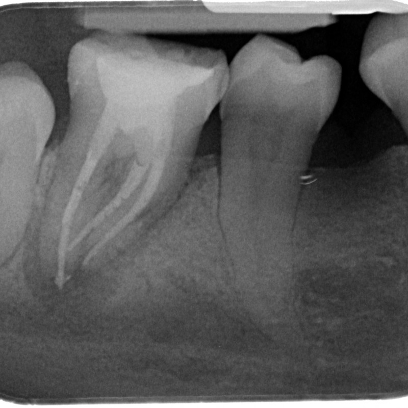 501805701-X-20141203-120614-XIXK5A0EAP9Y-4