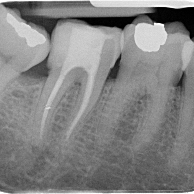 620717-85-5039-X-20150107-165741-X7+FQNZ7FXVD-4