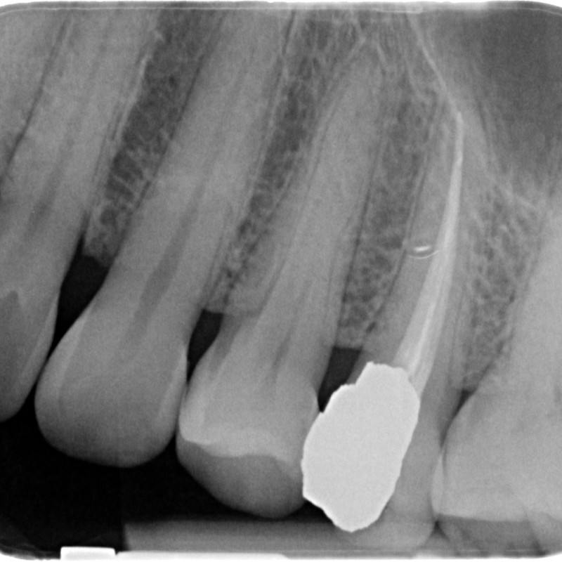 720225-10-5934-X-20150205-115733-XGRBETELS4WS-4