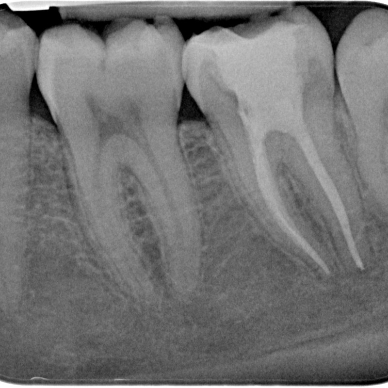 A6048727-X-20140620-114622-XAGRXDYVES6Y-4